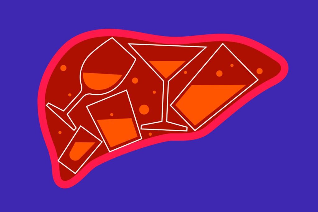 heavy-drinking-linked-to-surge-in-serious-liver-disease