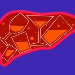 heavy-drinking-linked-to-surge-in-serious-liver-disease