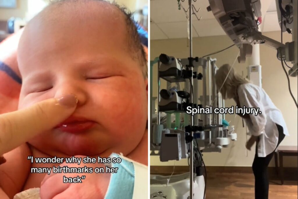 new-mom-faces-heartbreaking-diagnosis-after-baby-s-birthmarks