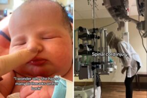 new-mom-faces-heartbreaking-diagnosis-after-baby-s-birthmarks