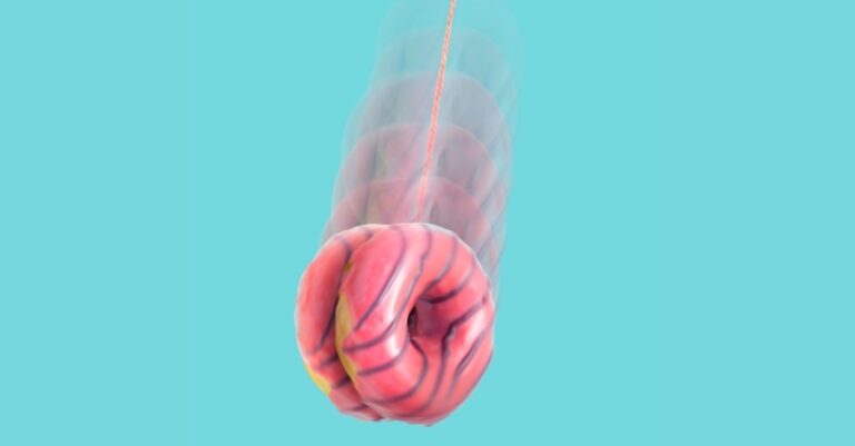 new-study-reveals-fad-diets-may-alter-brain-gut-health