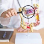 pds-biotechnology-completes-recruitment-for-colorectal-cancer-trial