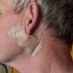 gordon-ramsay-undergoes-urgent-surgery-for-skin-cancer-removal