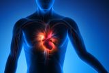 study-reveals-bacterial-infections-linked-to-heart-attacks