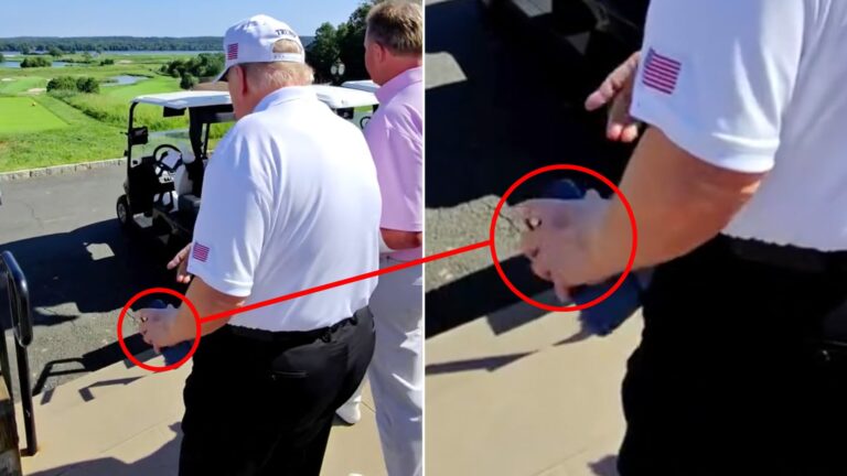 trump-spotted-with-new-bruise-health-questions-intensify