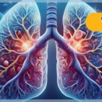 durvalumab-and-chemoradiotherapy-show-no-survival-benefits-in-nsclc