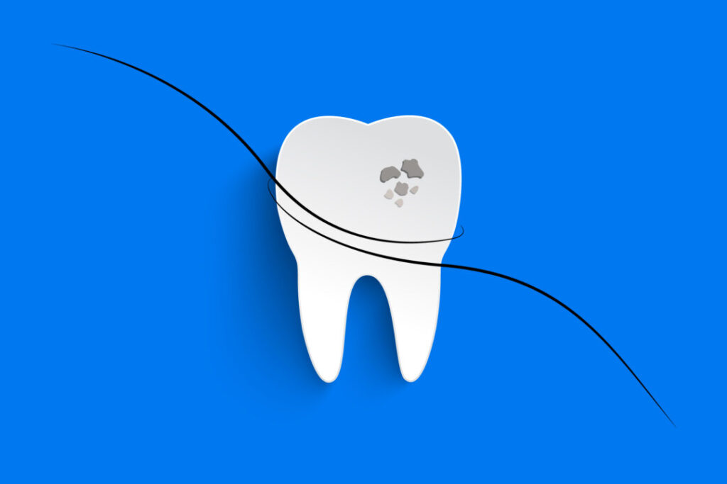 new-toothpaste-ingredient-from-hair-protein-could-replace-fillings