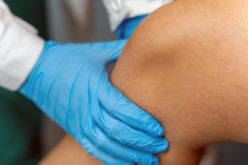 noisy-knees-after-acl-injury-don-t-predict-future-arthritis