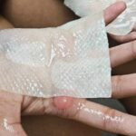 parents-demand-accountability-after-students-suffer-burns-in-practice