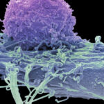 car-t-therapies-show-promise-in-treating-autoimmune-disorders