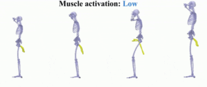 generative-ai-model-aims-to-revolutionize-athlete-injury-prevention