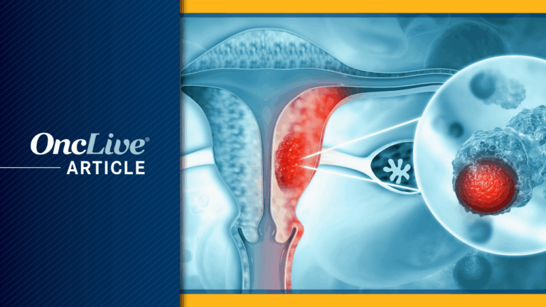 high-aneuploidy-scores-linked-to-poor-immunotherapy-outcomes