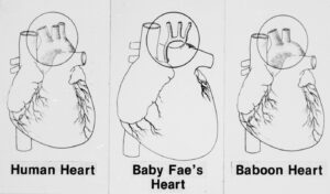 newborn-receives-baboon-heart-in-historic-transplant-oct-26