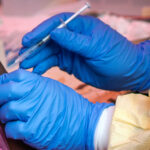 Congo-Medicine-Shortage