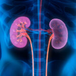 roche-s-gazyva-gains-fda-approval-for-lupus-nephritis-treatment