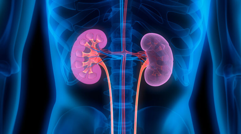 roche-s-gazyva-gains-fda-approval-for-lupus-nephritis-treatment