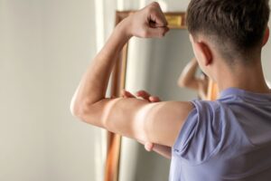 surge-in-male-body-dysmorphic-disorder-calls-for-urgent-attention