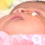 tucson-baby-s-life-saved-through-innovative-fetal-surgery