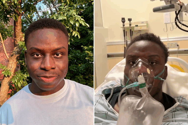 24-year-old-man-survives-life-threatening-blood-clots-after-misdiagnosis