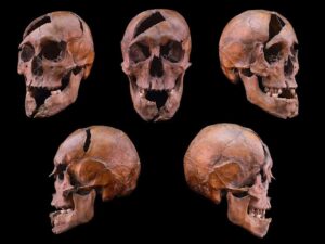 dna-analysis-unveils-identity-of-medieval-royalty-and-violent-demise