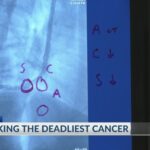 savannah-doctors-harness-cutting-edge-robotics-to-combat-lung-cancer