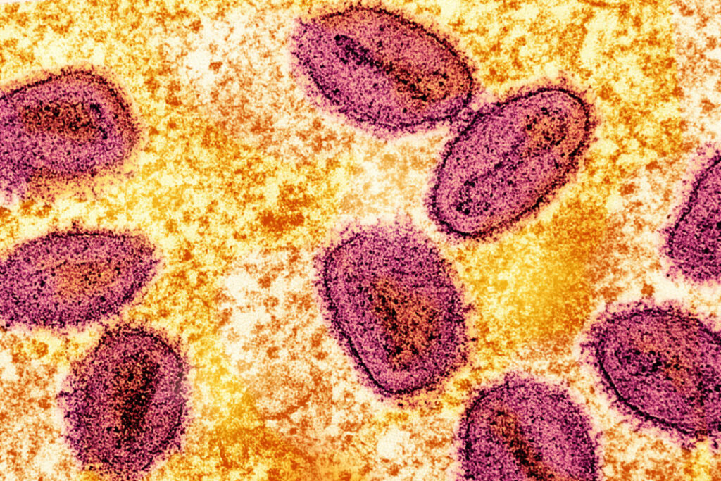 Colorized transmission electron micrograph of mpox virus particles captured at the NIAID Integrated Research Facility in Fort Detrick