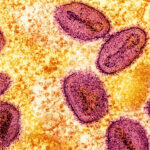 Colorized transmission electron micrograph of mpox virus particles captured at the NIAID Integrated Research Facility in Fort Detrick