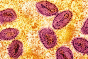 Colorized transmission electron micrograph of mpox virus particles captured at the NIAID Integrated Research Facility in Fort Detrick