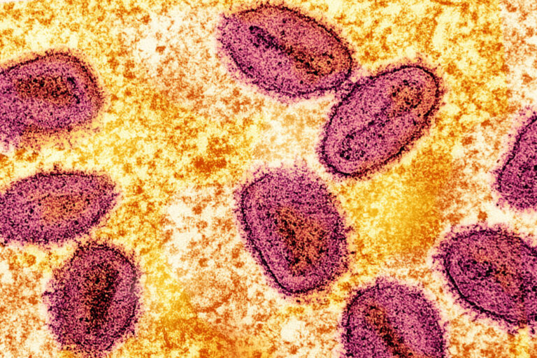 Colorized transmission electron micrograph of mpox virus particles captured at the NIAID Integrated Research Facility in Fort Detrick