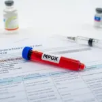 who-reports-surge-in-mpox-cases-as-new-strain-emerges-globally