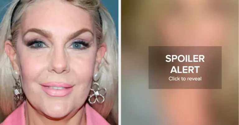 woman-challenges-plastic-surgery-stereotypes-in-viral-video