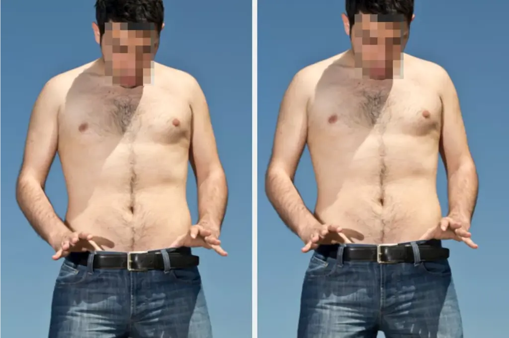 younger-men-drive-surge-in-vasectomy-interest-post-dobbs-ruling