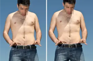 younger-men-drive-surge-in-vasectomy-interest-post-dobbs-ruling