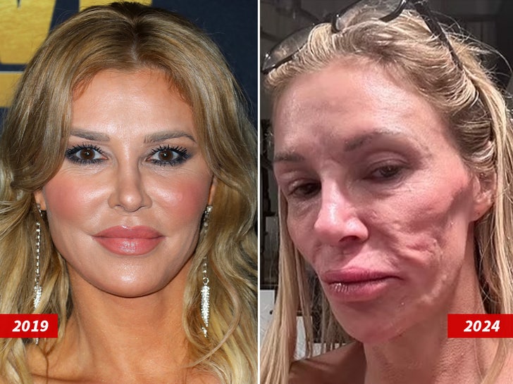 brandi-glanville-diagnosed-with-face-parasite-after-years-of-struggle