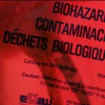 california-mortuary-mistakenly-hands-over-man-s-son-s-brain