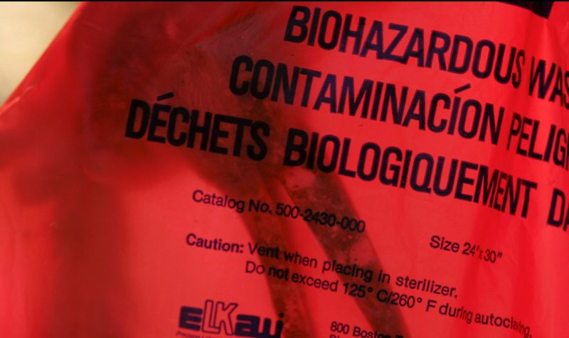 california-mortuary-mistakenly-hands-over-man-s-son-s-brain