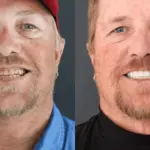 discover-the-comfort-of-dental-implants-myths-debunked