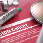 prioritize-early-cancer-screenings-to-save-lives