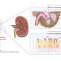 researchers-explore-stem-cell-vesicles-for-kidney-injury-treatment