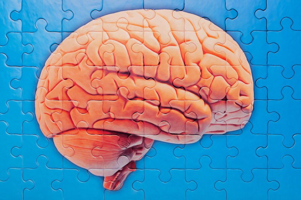 scientists-develop-potential-alzheimer-s-treatment-to-manage-like-cholesterol