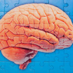 scientists-develop-potential-alzheimer-s-treatment-to-manage-like-cholesterol