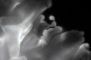 scientists-discover-origami-like-folding-in-simple-animal