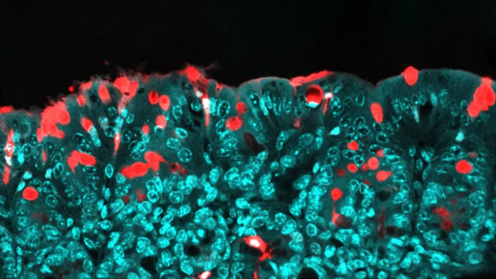 study-links-common-food-additive-to-long-term-health-risks-in-offspring