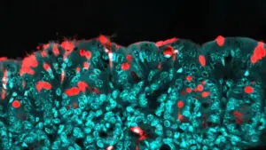 study-links-common-food-additive-to-long-term-health-risks-in-offspring