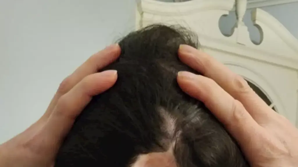 unraveling-the-impact-of-childhood-trauma-on-adult-health