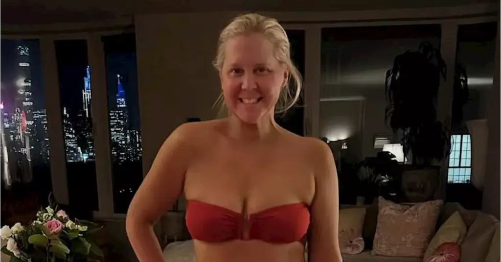 amy-schumer-showcases-body-positivity-after-50-pound-weight-loss