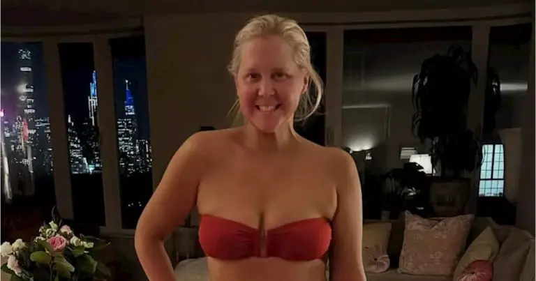 amy-schumer-showcases-body-positivity-after-50-pound-weight-loss