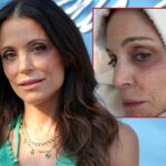 bethenny-frankel-faces-urgent-health-scare-from-bacterial-infection