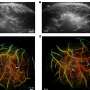 innovative-3d-hybrid-imaging-system-sets-new-standard-for-medical-imaging