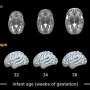 new-insights-on-newborn-brain-development-unveiled